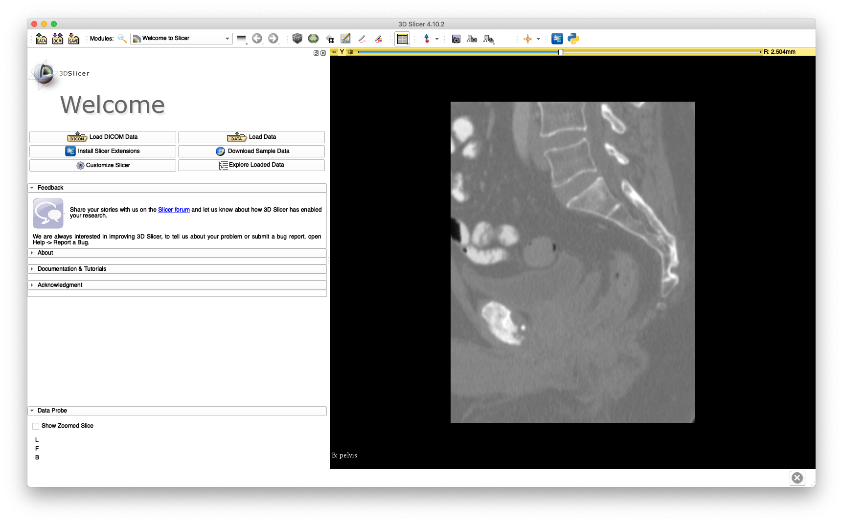 Slicer Sagittal Crop