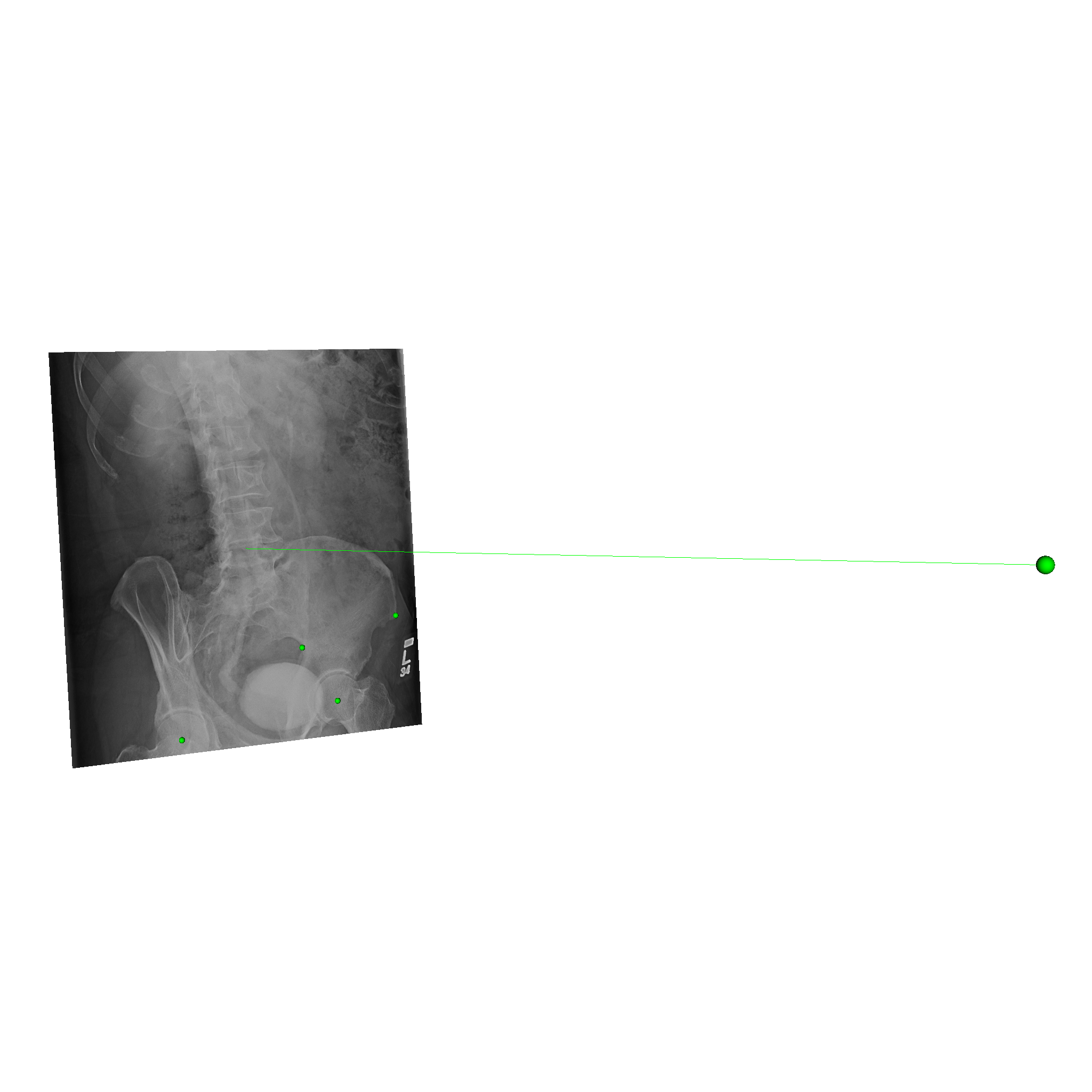 1-bd7b Projection View