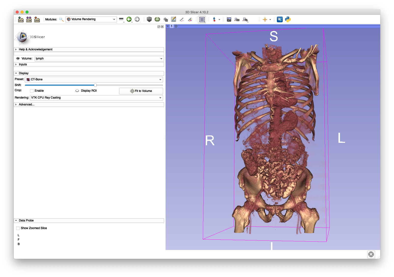 Example 1 Volume Rendering