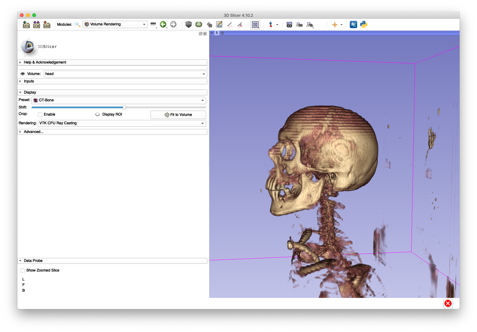 Example 2 Good Volume Rendering