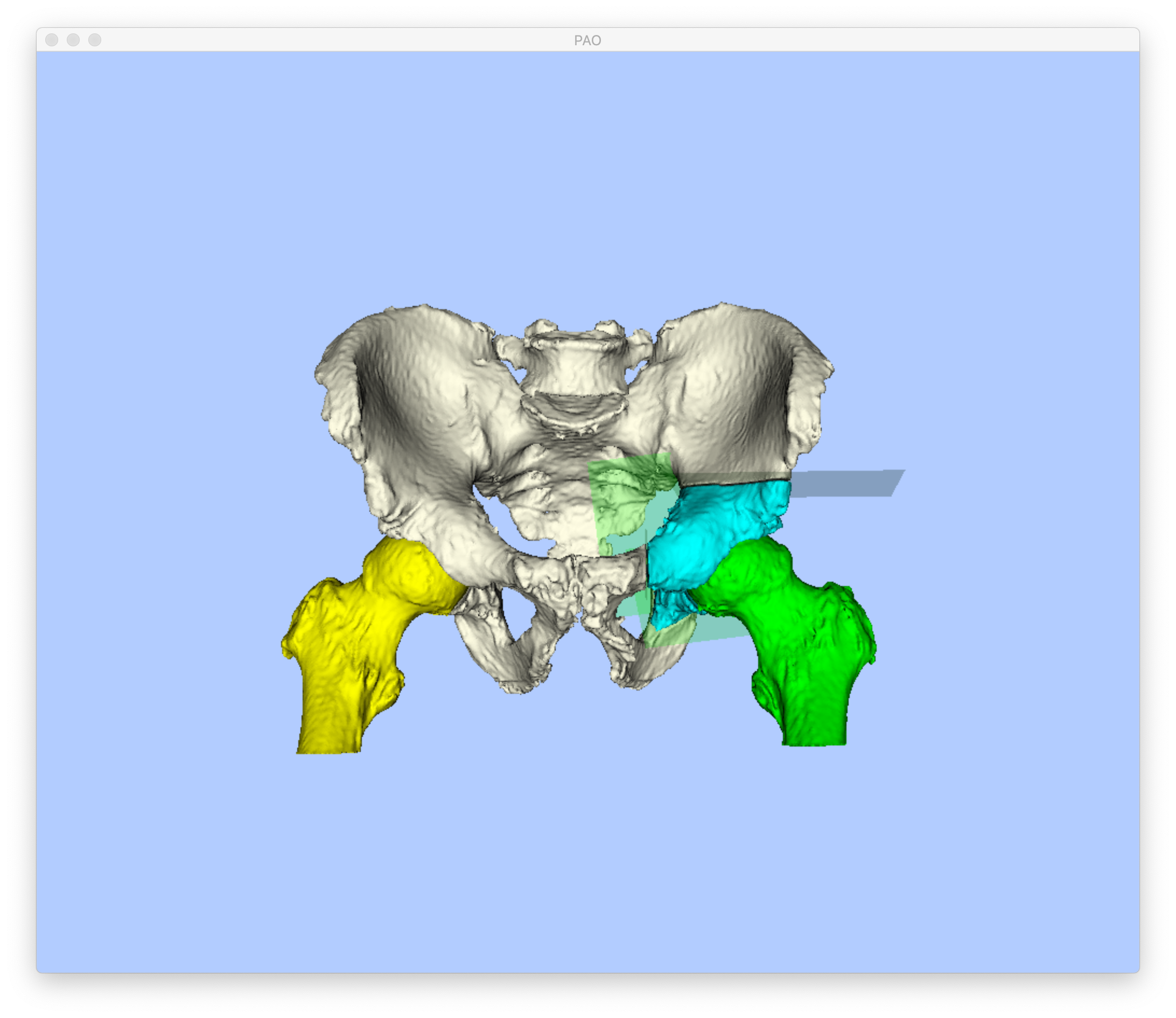 Example 1 Cuts Display 1