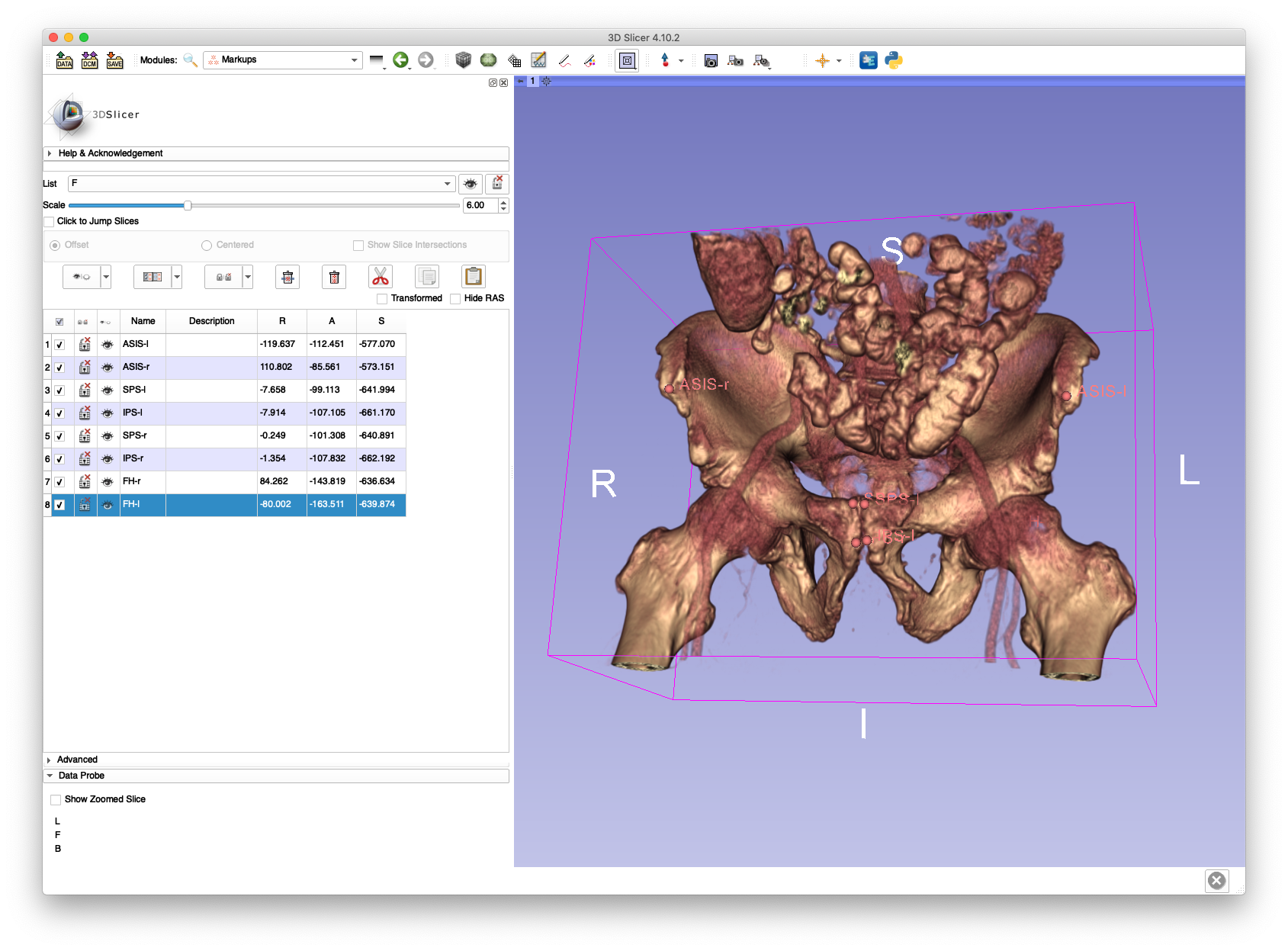 Example Pelvis APP Landmarks 1