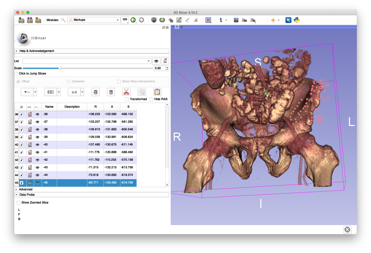 Example Pelvis Intraop Point Cloud