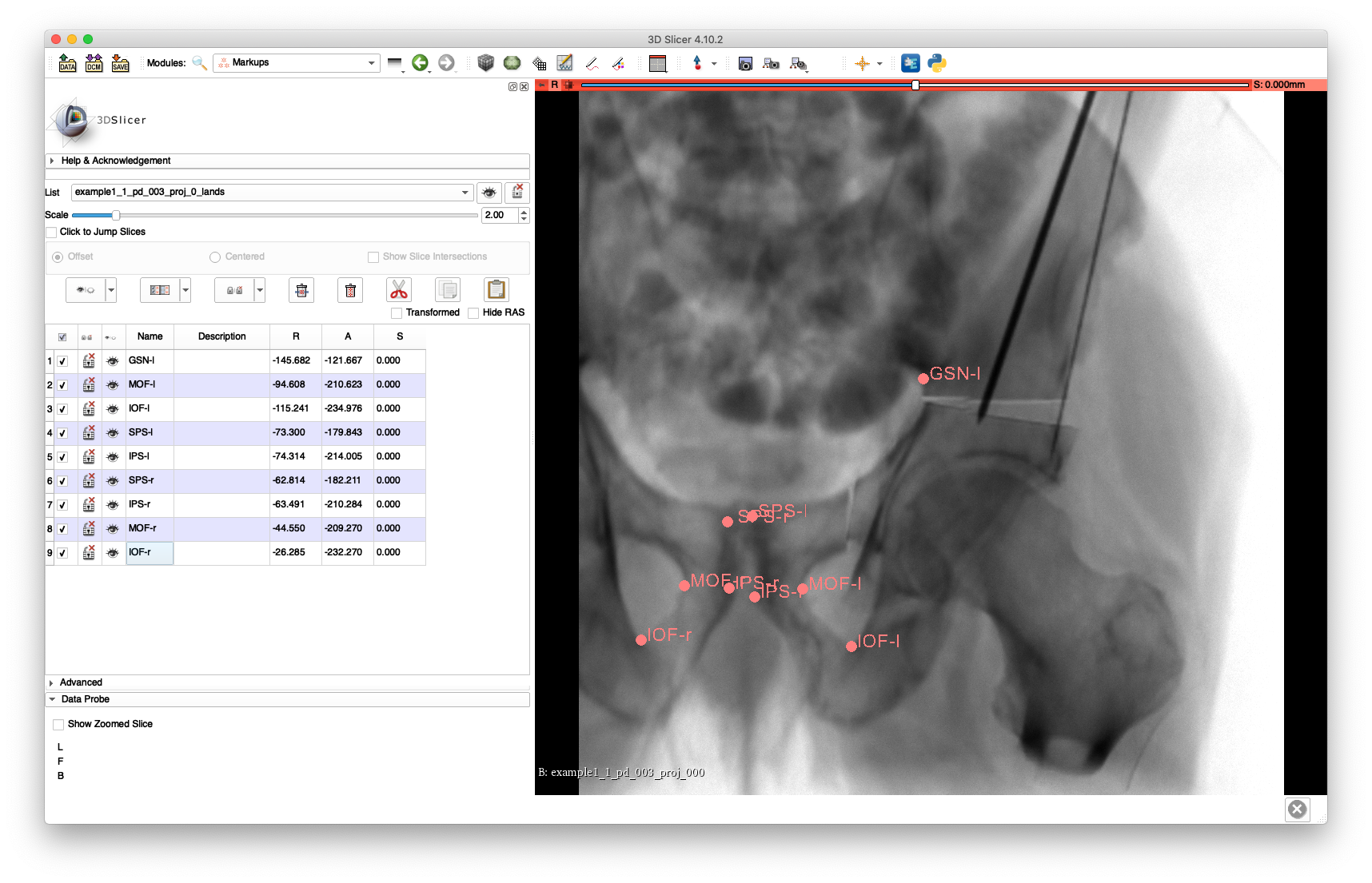 Example 1 2D Registration Landmarks