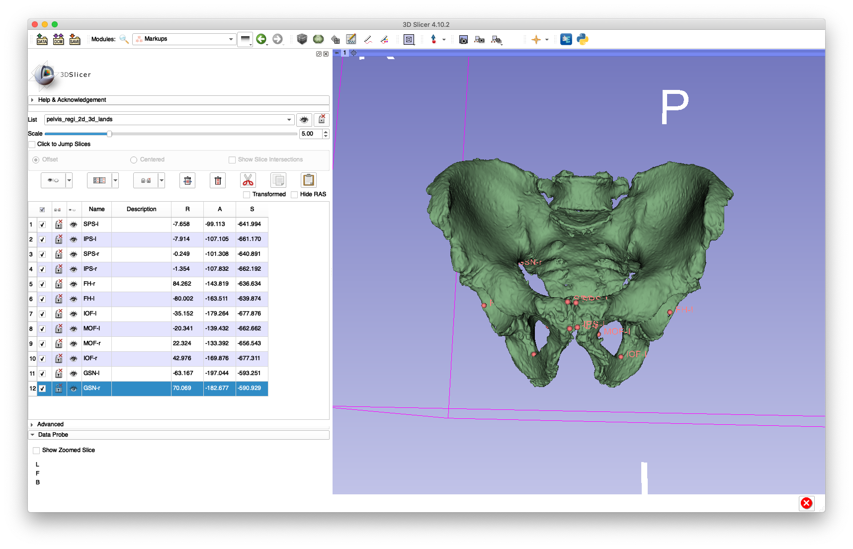 Example 1 3D Registration Landmarks 1