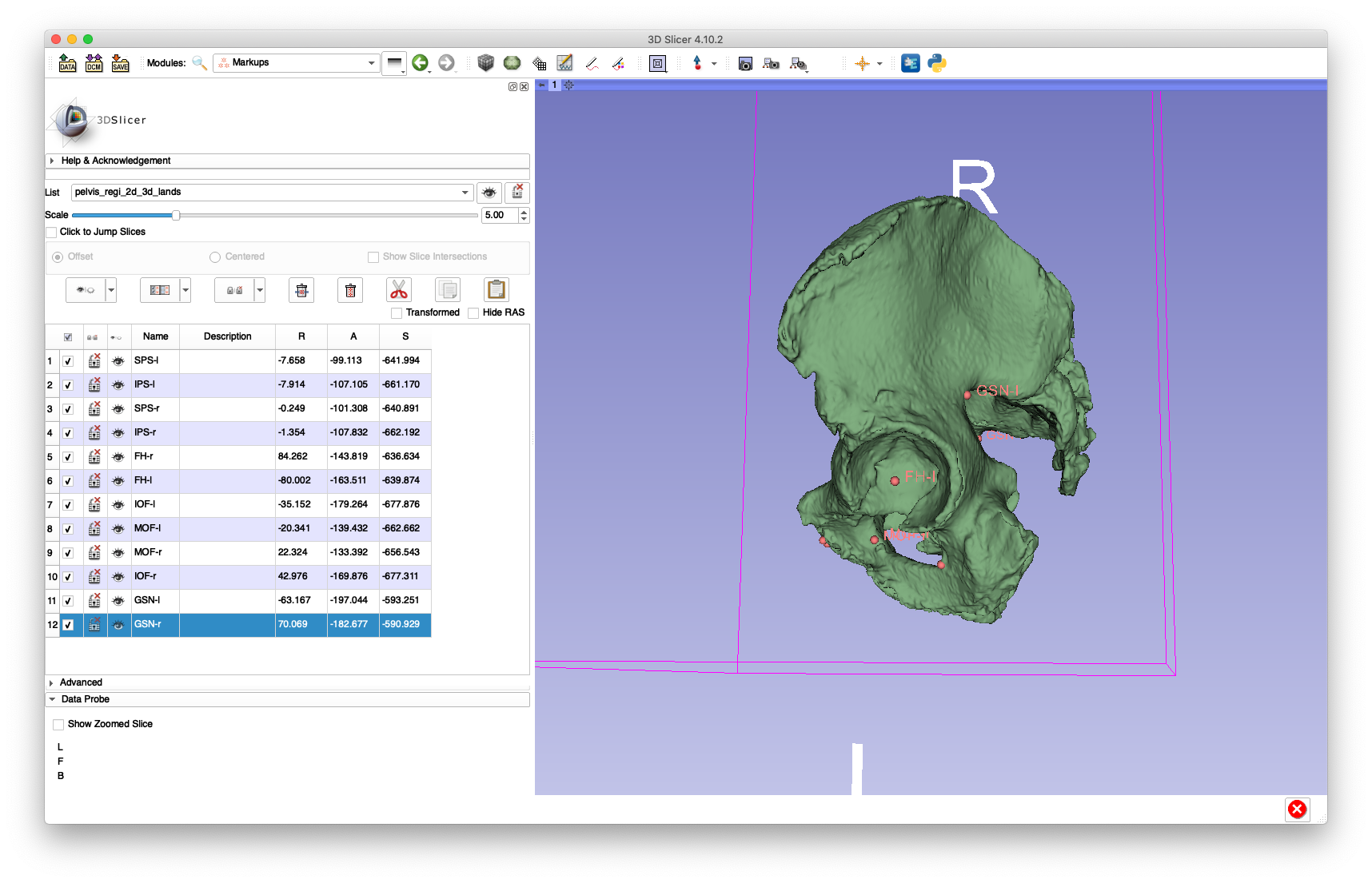 Example 1 3D Registration Landmarks 2